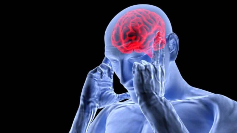 Brain-2