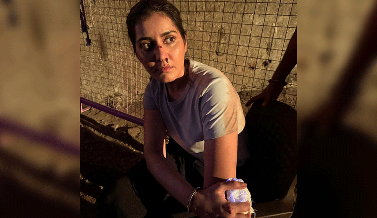 Heroine-Raashi-Khanna-injured-during-shooting