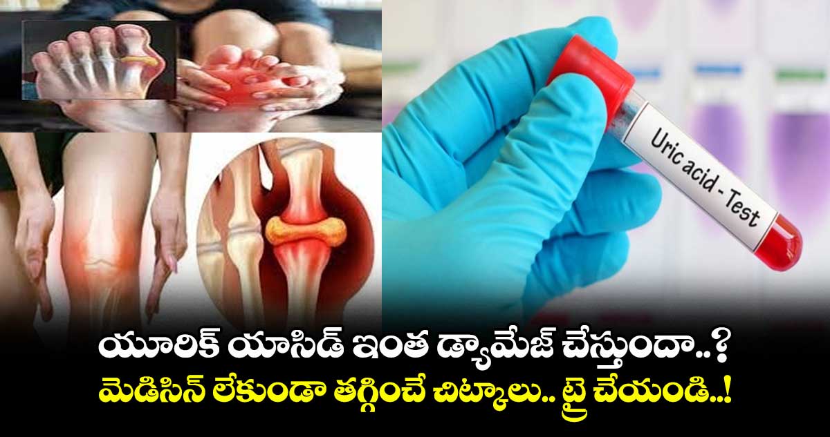 does-uric-acid-cause-so-much-damage-tips-to-reduce-it-without-medicine_8JPmpEe6Zc